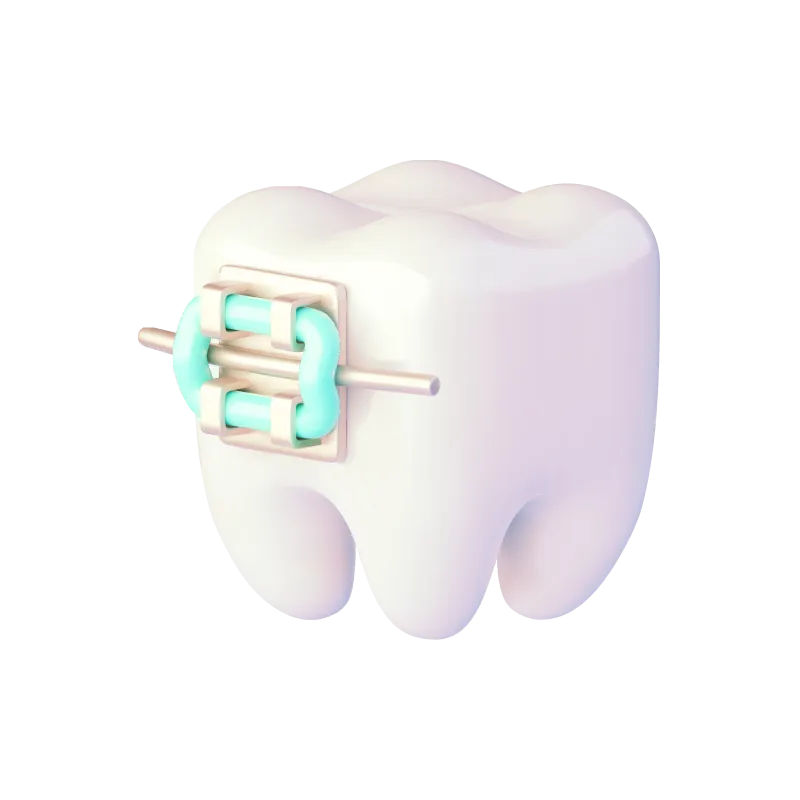 Зуб с брекет-системой