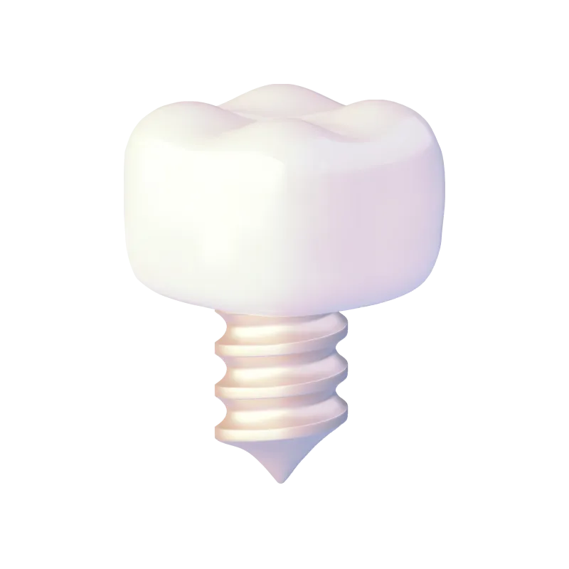 Зубной имплант