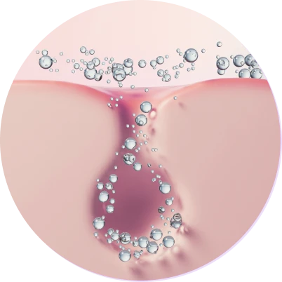 удаление загрязнений