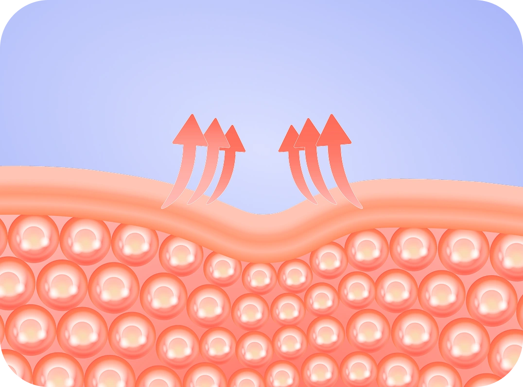 Укрепление волосянных луковиц.
