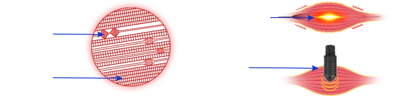 триггерные точки