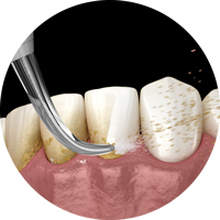 Ирригатор Yamaguchi Oral Care