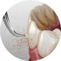 Ирригатор Yamaguchi Oral Care