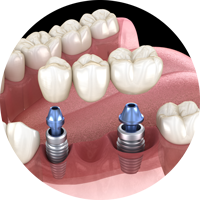 Ирригатор Yamaguchi Oral Care