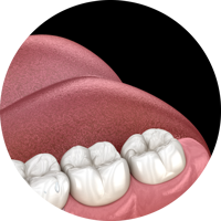 Ирригатор Yamaguchi Oral Care